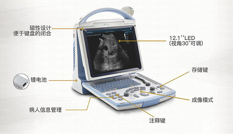 B超機的基本構件包括發射、掃查、接收、信號處理和顯示等五個主要組成部分，分別分為兩大部件，即主機和探頭。